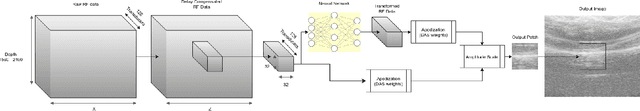 Figure 1 for Patch Based Transformation for Minimum Variance Beamformer Image Approximation Using Delay and Sum Pipeline