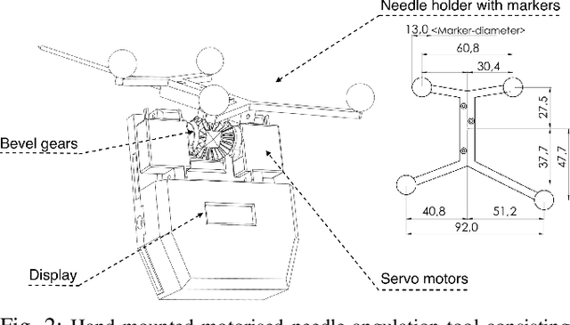 Figure 2 for Image-guided Breast Biopsy of MRI-visible Lesions with a Hand-mounted Motorised Needle Steering Tool