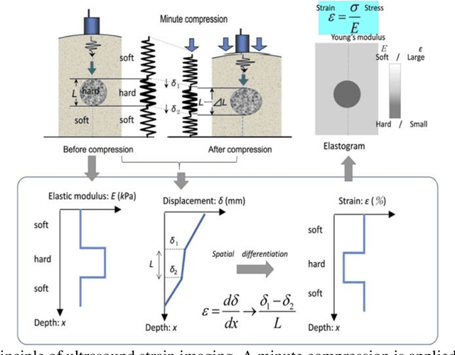 Figure 4 for Deep Learning in Ultrasound Elastography Imaging