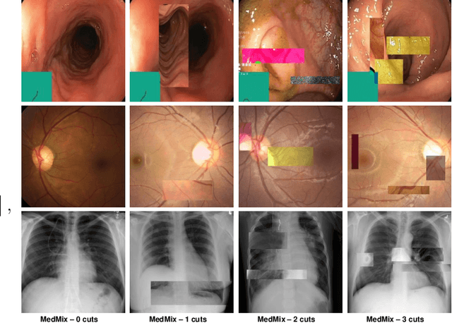 Figure 2 for Multi-centred Strong Augmentation via Contrastive Learning for Unsupervised Lesion Detection and Segmentation