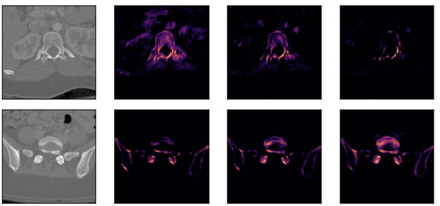 Figure 3 for Deep Sequential Segmentation of Organs in Volumetric Medical Scans
