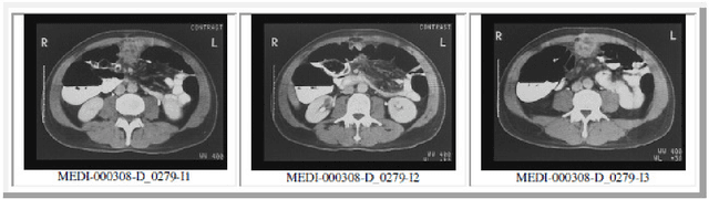 Figure 4 for Using Hausdorff Distance for New Medical Image Annotation