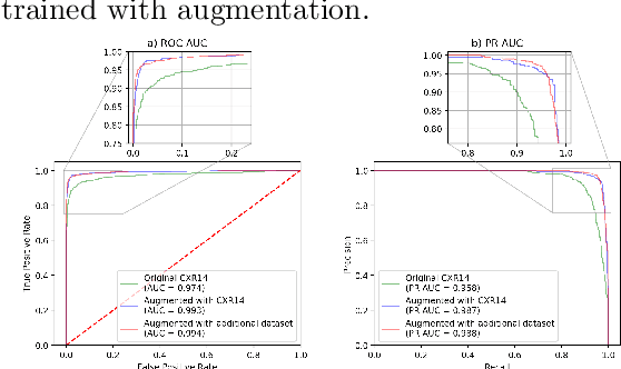 Figure 3 for GANs 'N Lungs: improving pneumonia prediction