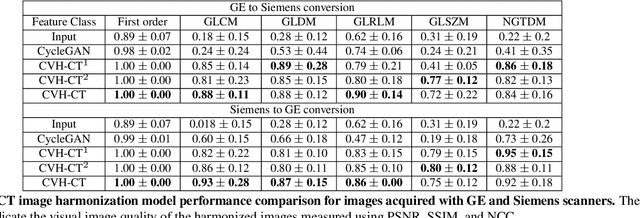 Figure 4 for Cross-Vendor CT Image Data Harmonization Using CVH-CT