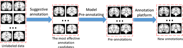Figure 3 for Efforts estimation of doctors annotating medical image