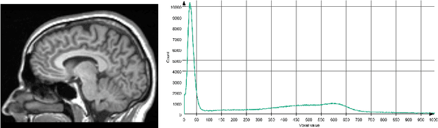 Figure 4 for Generative Adversarial Networks and Other Generative Models