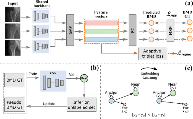 Figure 1 for Semi-Supervised Learning for Bone Mineral Density Estimation in Hip X-ray Images