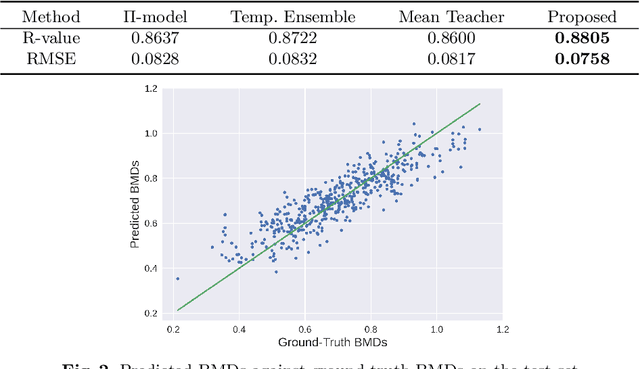 Figure 3 for Semi-Supervised Learning for Bone Mineral Density Estimation in Hip X-ray Images