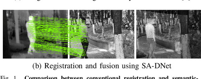 Figure 1 for SA-DNet: A on-demand semantic object registration network adapting to non-rigid deformation