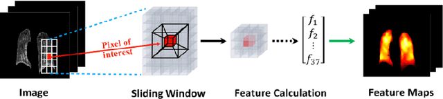 Figure 3 for A Radiomics-Boosted Deep-Learning Model for COVID-19 and Non-COVID-19 Pneumonia Detection Using Chest X-ray Image