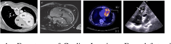 Figure 1 for Unsupervised Domain Adaptation for Cardiac Segmentation: Towards Structure Mutual Information Maximization