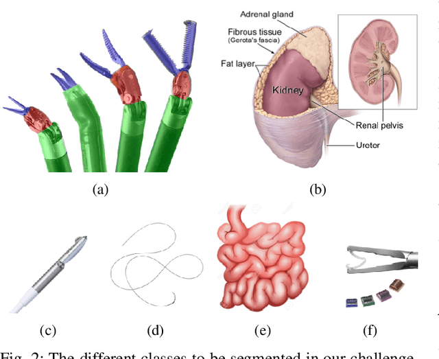 Figure 2 for 2018 Robotic Scene Segmentation Challenge