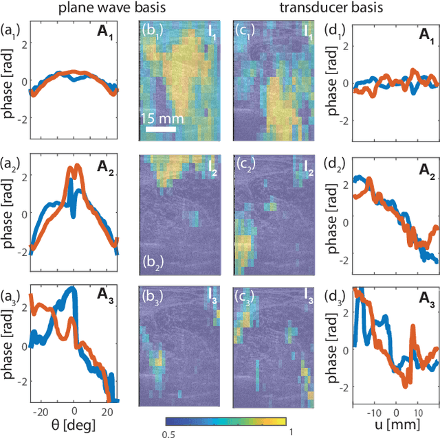 Figure 4 for Ultrasound Matrix Imaging. II. The distortion matrix for aberration correction over multiple isoplanatic patches