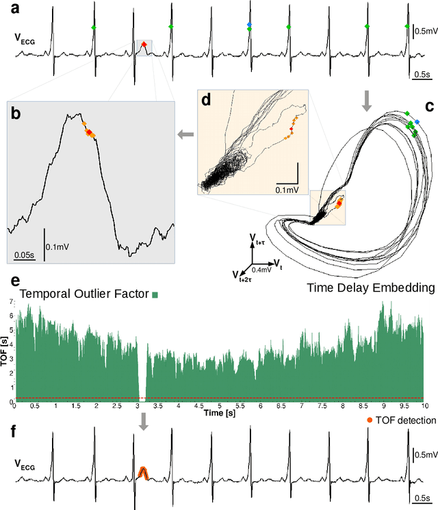 Figure 1 for How to find a unicorn: a novel model-free, unsupervised anomaly detection method for time series