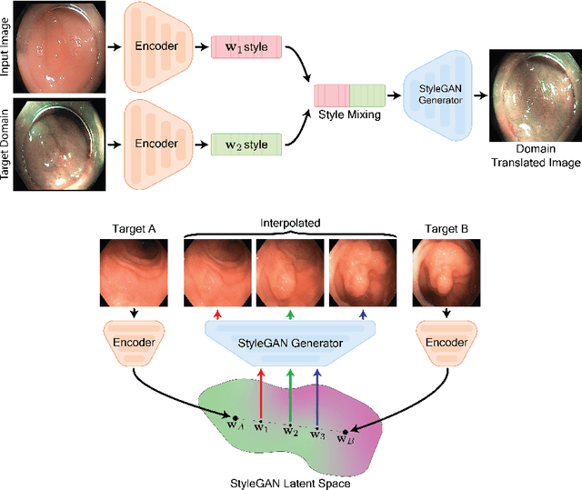 Figure 1 for GAN Inversion for Data Augmentation to Improve Colonoscopy Lesion Classification