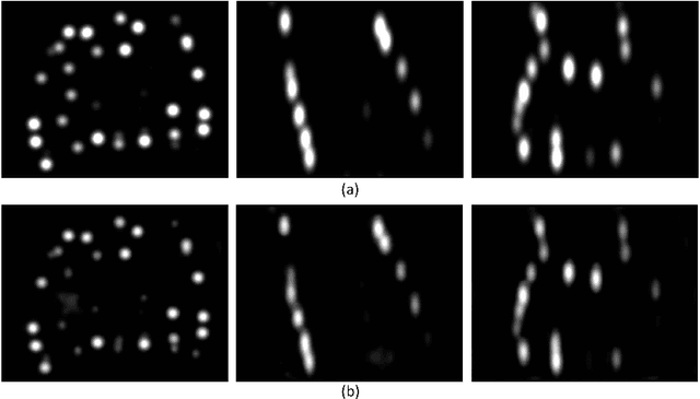 Figure 3 for A Deep Regression Model for Seed Identification in Prostate Brachytherapy