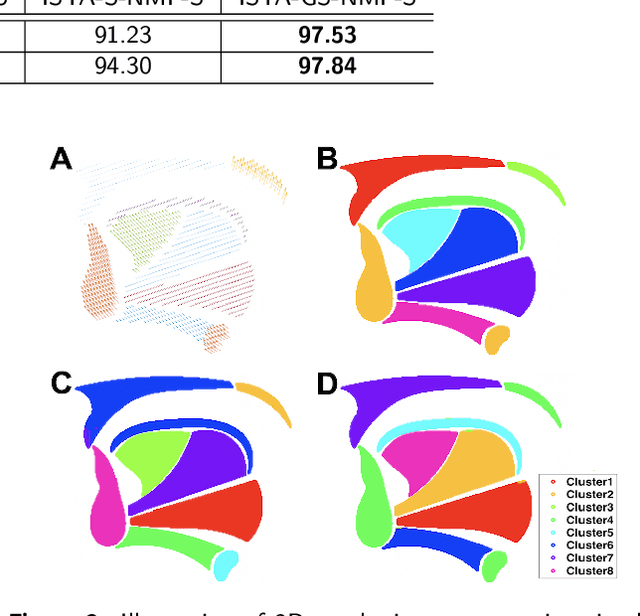 Figure 4 for A Deep Joint Sparse Non-negative Matrix Factorization Framework for Identifying the Common and Subject-specific Functional Units of Tongue Motion During Speech