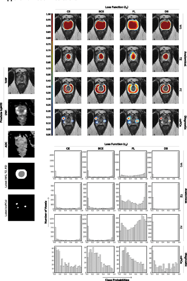 Figure 3 for Anatomical and Diagnostic Bayesian Segmentation in Prostate MRI $-$Should Different Clinical Objectives Mandate Different Loss Functions?