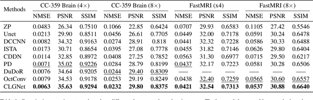 Figure 2 for Contrastive Learning for Local and Global Learning MRI Reconstruction