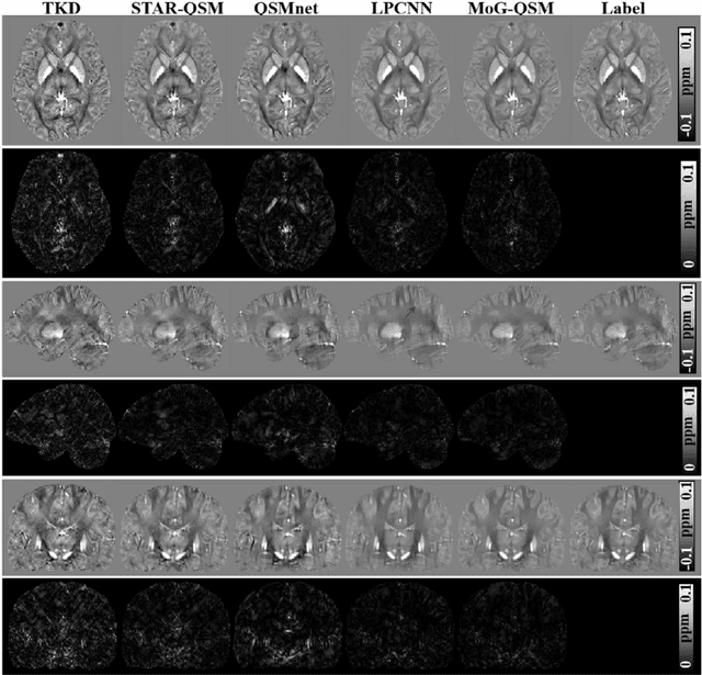 Figure 3 for MoG-QSM: Model-based Generative Adversarial Deep Learning Network for Quantitative Susceptibility Mapping