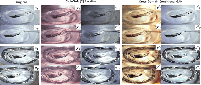 Figure 3 for Cross-Domain Conditional Generative Adversarial Networks for Stereoscopic Hyperrealism in Surgical Training