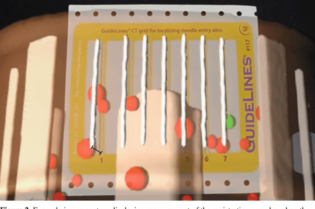 Figure 3 for Multicenter Assessment of Augmented Reality Registration Methods for Image-guided Interventions