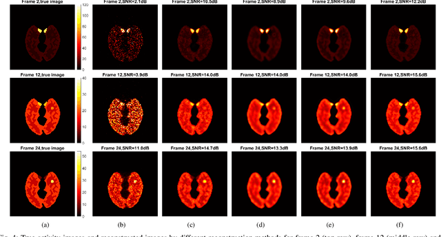 Figure 4 for Neural KEM: A Kernel Method with Deep Coefficient Prior for PET Image Reconstruction