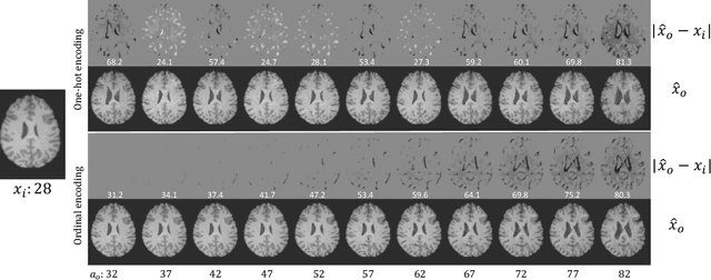 Figure 2 for Learning to synthesise the ageing brain without longitudinal data