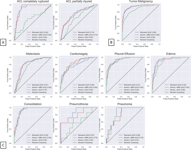 Figure 3 for Advancing diagnostic performance and clinical usability of neural networks via adversarial training and dual batch normalization