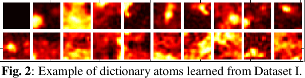 Figure 4 for Patch-based Sparse Representation For Bacterial Detection
