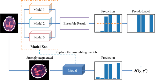 Figure 3 for An Effective Transformer-based Solution for RSNA Intracranial Hemorrhage Detection Competition