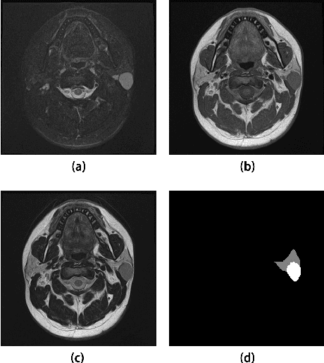 Figure 1 for Parotid Gland MRI Segmentation Based on Swin-Unet and Multimodal Images
