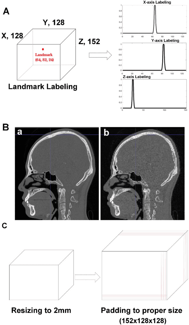 Figure 2 for Automatic Three-Dimensional Cephalometric Annotation System Using Three-Dimensional Convolutional Neural Networks