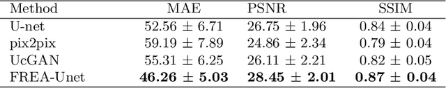 Figure 4 for FREA-Unet: Frequency-aware U-net for Modality Transfer