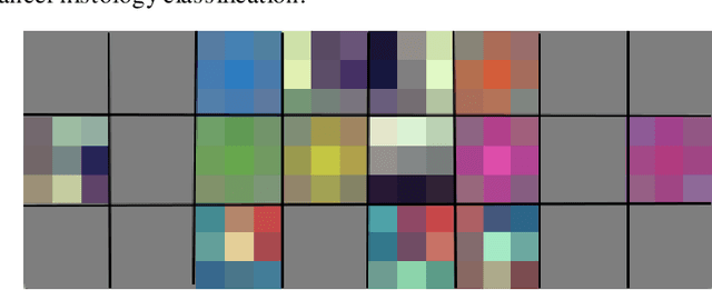 Figure 2 for Inception Architecture and Residual Connections in Classification of Breast Cancer Histology Images