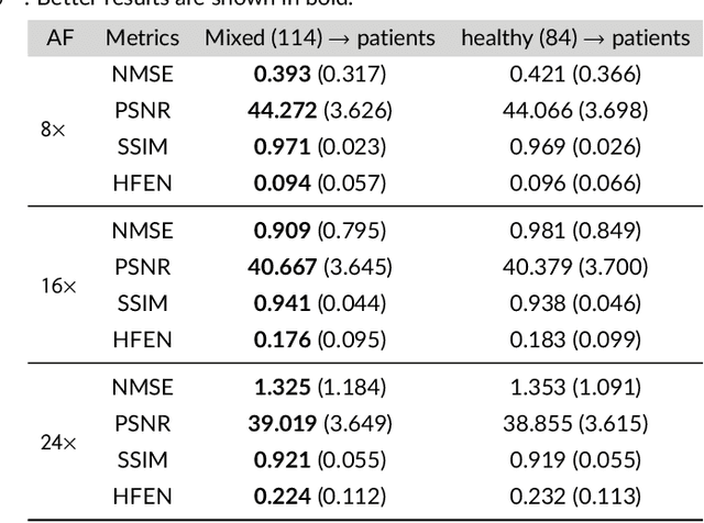 Figure 3 for Complementary Time-Frequency Domain Networks for Dynamic Parallel MR Image Reconstruction