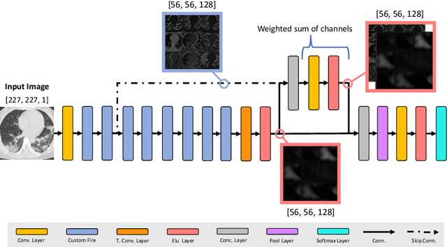 Figure 4 for A Light CNN for detecting COVID-19 from CT scans of the chest