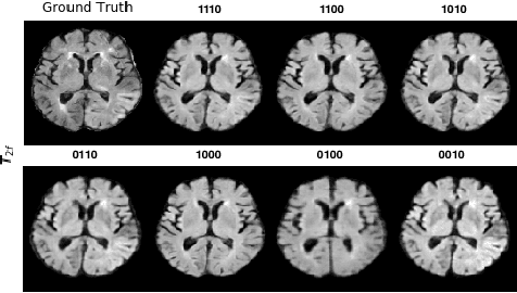 Figure 2 for Missing MRI Pulse Sequence Synthesis using Multi-Modal Generative Adversarial Network