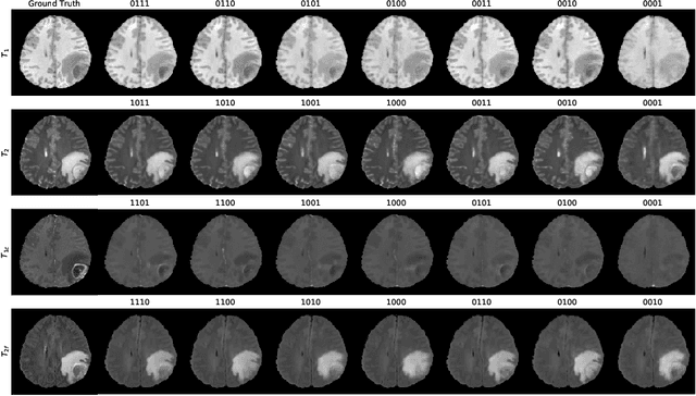 Figure 3 for Missing MRI Pulse Sequence Synthesis using Multi-Modal Generative Adversarial Network