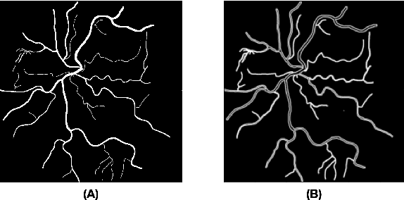 Figure 4 for PVBM: A Python Vasculature Biomarker Toolbox Based On Retinal Blood Vessel Segmentation