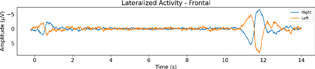 Figure 4 for Significant changes in EEG neural oscillations during different phases of three-dimensional multiple object tracking task (3D-MOT) imply different roles for attention and working memory