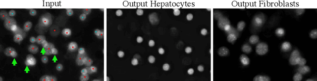 Figure 4 for Semantic filtering through deep source separation on microscopy images