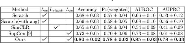 Figure 2 for Supervised Contrastive Learning to Classify Paranasal Anomalies in the Maxillary Sinus