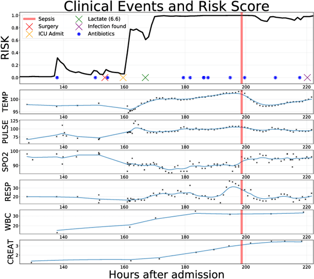 Figure 1 for An Improved Multi-Output Gaussian Process RNN with Real-Time Validation for Early Sepsis Detection