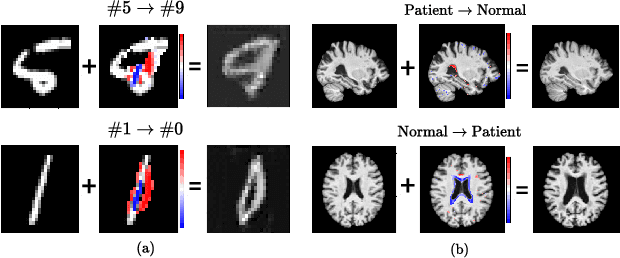 Figure 1 for Born Identity Network: Multi-way Counterfactual Map Generation to Explain a Classifier's Decision