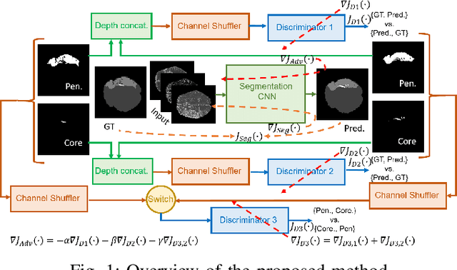 Figure 1 for Adversarially Trained Convolutional Neural Networks for Semantic Segmentation of Ischaemic Stroke Lesion using Multisequence Magnetic Resonance Imaging