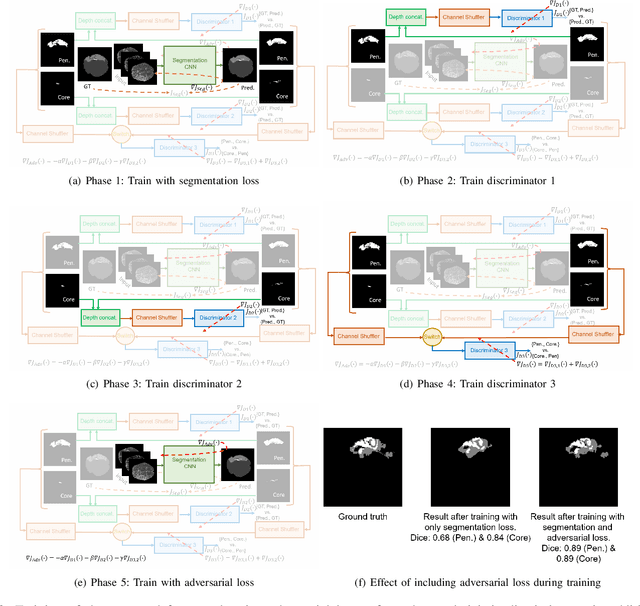 Figure 2 for Adversarially Trained Convolutional Neural Networks for Semantic Segmentation of Ischaemic Stroke Lesion using Multisequence Magnetic Resonance Imaging