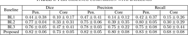 Figure 4 for Adversarially Trained Convolutional Neural Networks for Semantic Segmentation of Ischaemic Stroke Lesion using Multisequence Magnetic Resonance Imaging