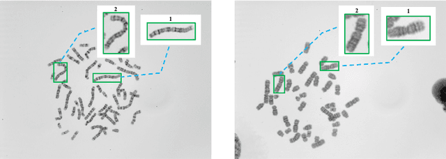 Figure 1 for DeepACC:Automate Chromosome Classification based on Metaphase Images using Deep Learning Framework Fused with Prior Knowledge
