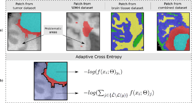 Figure 3 for Joint Learning of Brain Lesion and Anatomy Segmentation from Heterogeneous Datasets